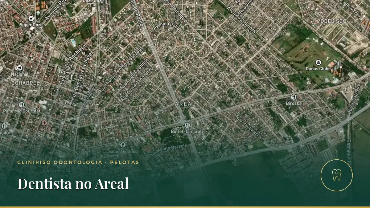 Dentista no Areal, Pelotas — Cliniriso, Pelotas