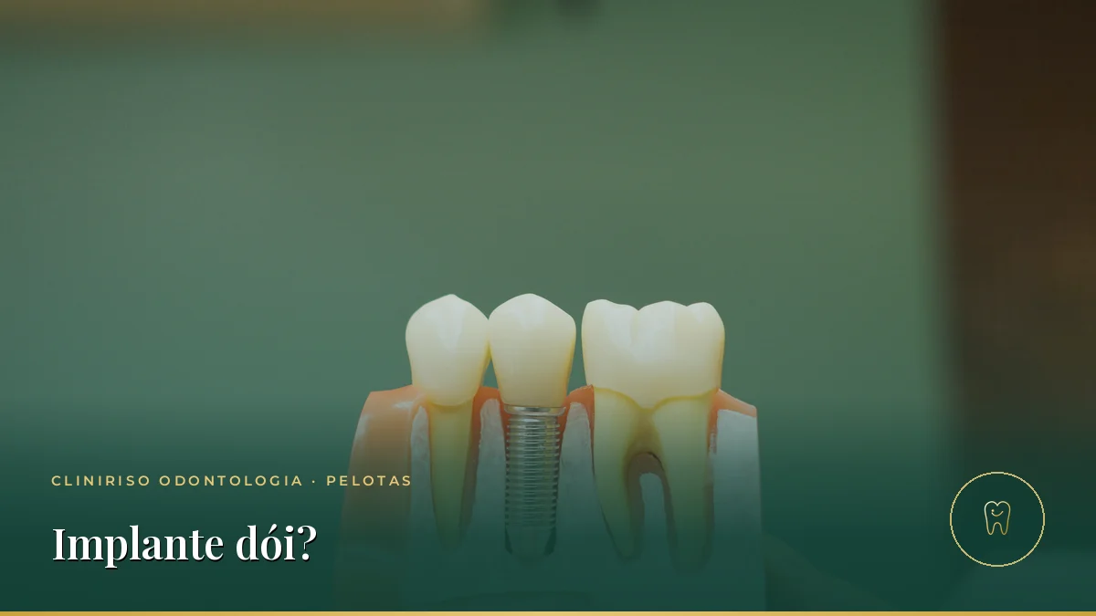 Implante dentário dói? O que esperar antes, durante e depois — Cliniriso, Pelotas