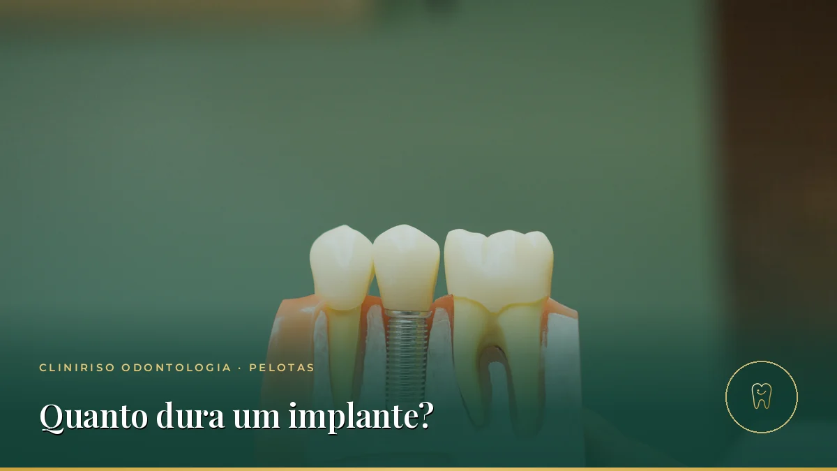 Quanto tempo dura um implante dentário? — Cliniriso, Pelotas